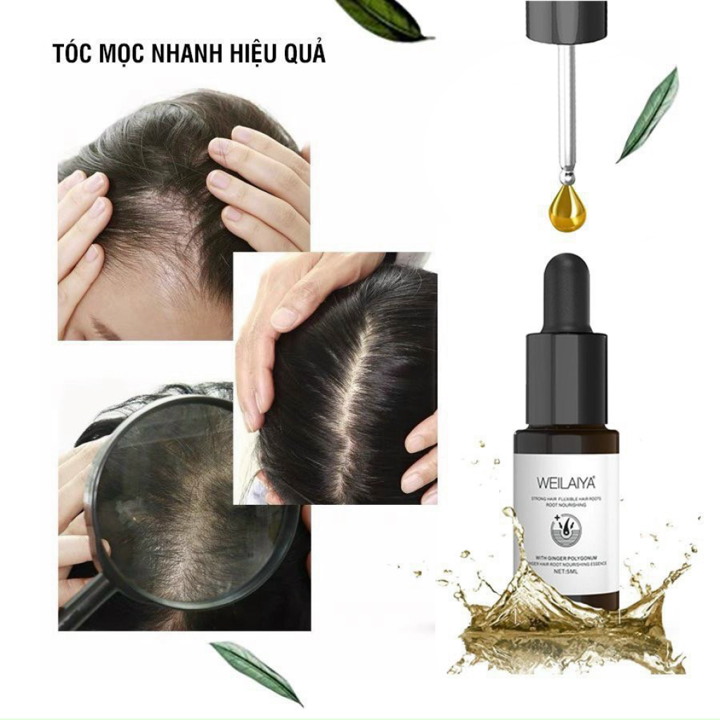 Huyết Thanh Serum Mọc Tóc Weilaiya Kích Thích Mọc Tóc Nhanh, An Toàn, Hiệu Qủa-WEILAIYA 