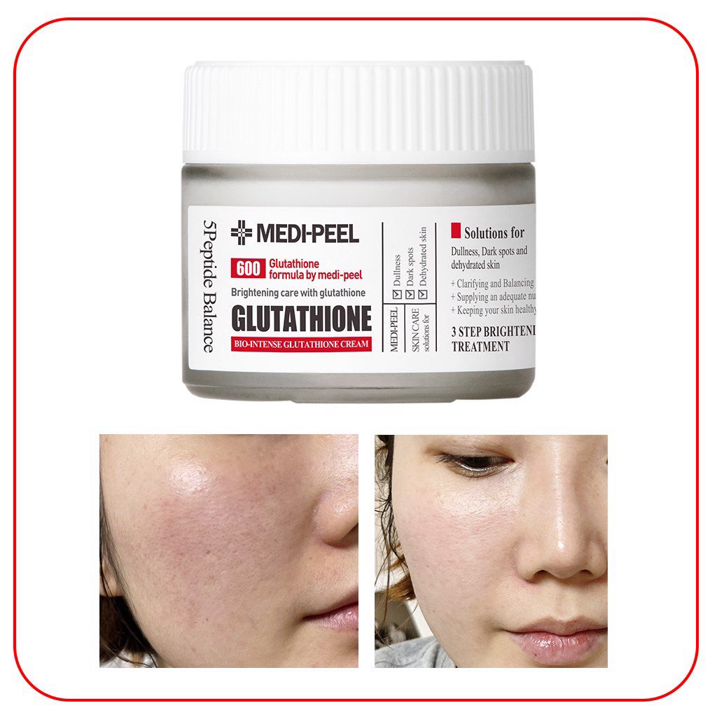 Kem Dưỡng Trắng Medi Peel Glutathione 600 White Cream Medi Peel
