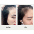 Dầu Gội Weilaiya Hỗ Trợ Mọc Tóc Nhanh Hạn Chế Rụng Tóc Tinh Chất Gừng Và Hà Thủ Ô Dành Cho Da Khô Gàu Nấm Ngứa 400ml