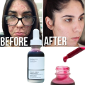 -The Ordinary- Peel Da Tẩy Da chết Hoá Học Thanh Tẩy Da Aha 30 - 2peeling